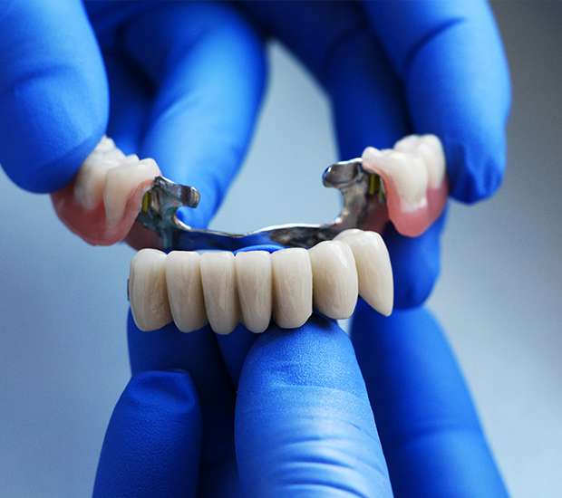 McKinney Dental Crowns
