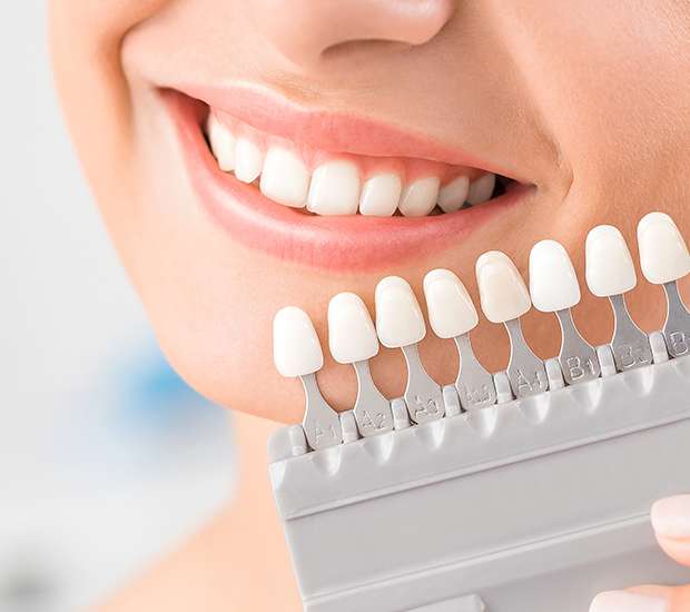 McKinney Veneers