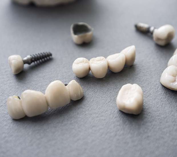 McKinney The Difference Between Dental Implants and Mini Dental Implants