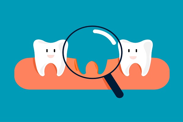 What To Do About A Missing Tooth