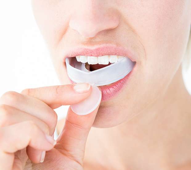 McKinney Mouth Guards