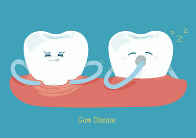 Periodontics