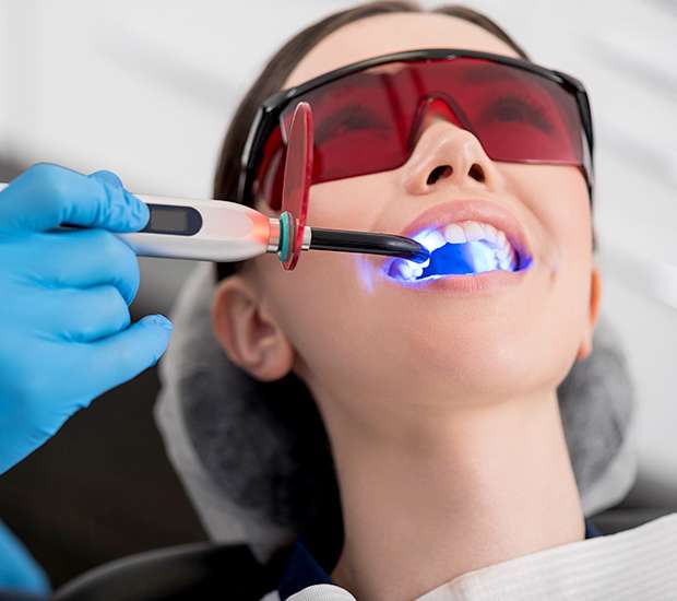 McKinney Professional Teeth Whitening