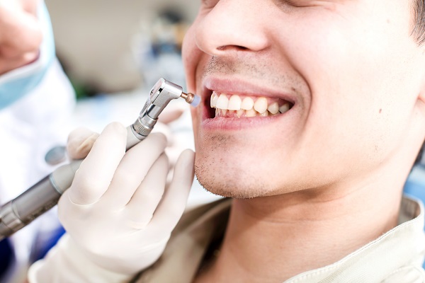 How Often Do I Need A Teeth Cleaning?