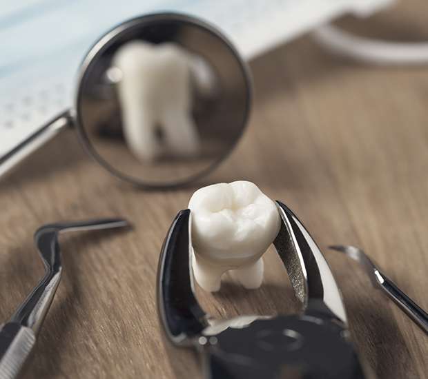 McKinney When Is a Tooth Extraction Necessary
